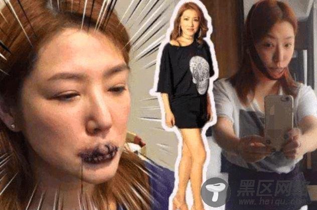 男友满天飞的“穆念慈”有多敬业?拍戏遭缝嘴