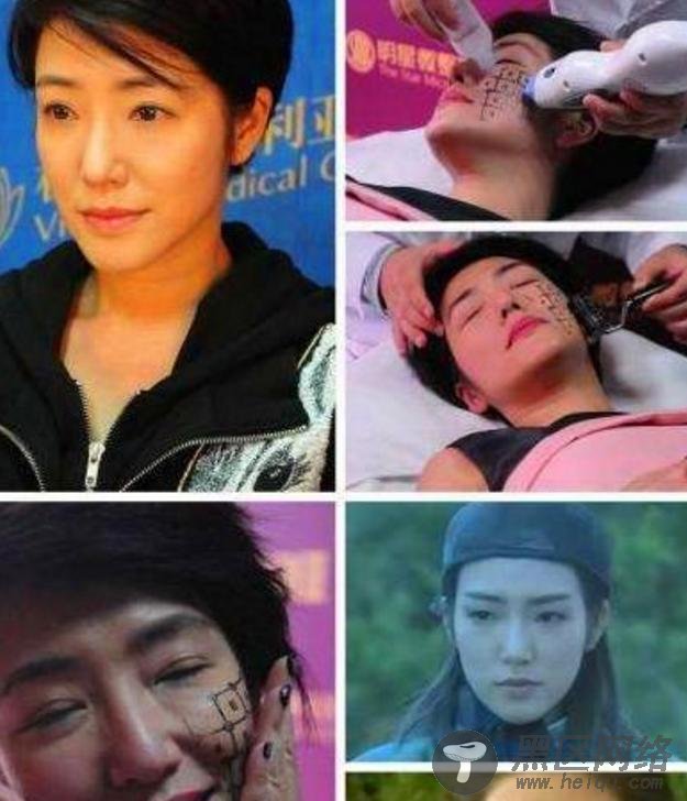 男友满天飞的“穆念慈”有多敬业?拍戏遭缝嘴