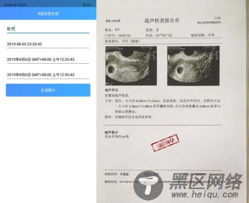 安卓怀孕恶搞B超检查生成器「手机软件」