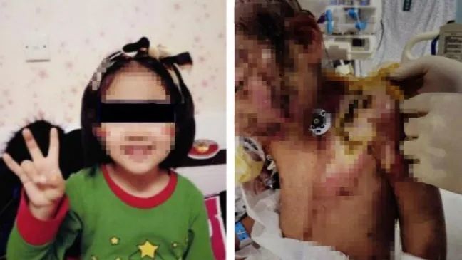156万！爱心如潮涌向辽宁6岁被虐女童，父亲：善