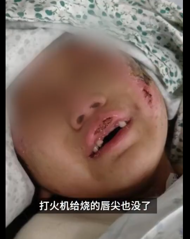 156万！爱心如潮涌向辽宁6岁被虐女童，父亲：善